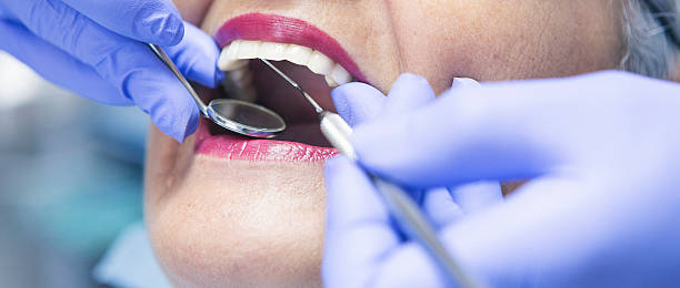 Best Emergency Dentist for Lost Fillings or Crowns in De Pere, WI